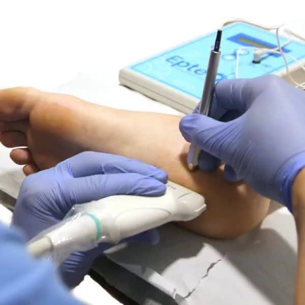 Fysiotherapie Noordkop gecertificeerde praktijk voor EPTE